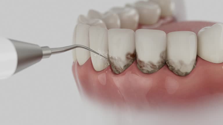 Reliable Dental Implants contractor in Lincoln County County, MT by Dentist Open Now